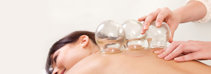 Chiropractic Rancho Mirage CA Cupping Treatment
